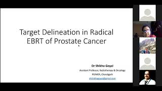 target delineation in radical EBRT of prostate cancer by Dr Shikha Goyal