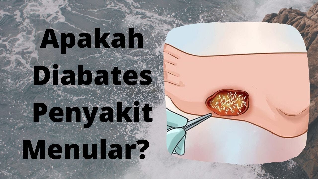 apa diabetes menular