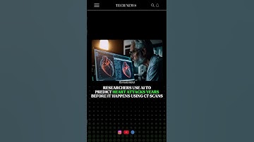RESEARCHERS USE AI TO PREDICT HEART ATTACKS YEARS BEFORE IT HAPPENS USING CT SCANS #shorts #technews