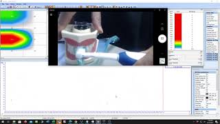Surface pressure mapping