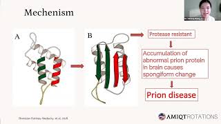 AMIQT - Dr. Yumeng Huang,, MALATTIA DA PRIONI