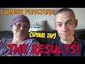 My Lumber Puncture - RESULTS! | Multiple Sclerosis | Chronic Illness