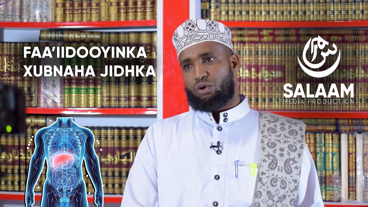 Maxaad Kala Socota Xubnaha Jidhkaaga iyo Khasaaraha Ay Ku Gelin Karaan?