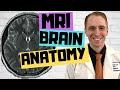 MRI Brain Anatomy Explained by Neurologist