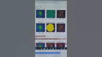 Medical image - Retina Vessel segmentation using Optimized Deep learning U-Net CNN || Python project