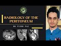 Radiology of the peritoneum  vivek pai  peritoneal spaces  abdominal ct  peritoneal mets