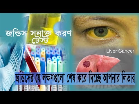 যে লক্ষণগুলো ধীরে ধীরে শেষ করে দিচ্ছে আপনার লিভার