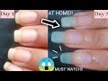 How to grow Nails FAST at Home in Just 7 days 😱 | Tips to grow Nails Fast 😱