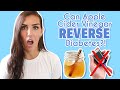 Apple Cider Vinegar Benefits | Can It Reverse Insulin Resistance and Type 2 Diabetes?!