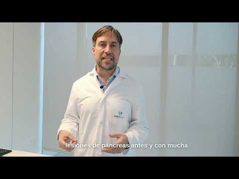 Cáncer de páncreas