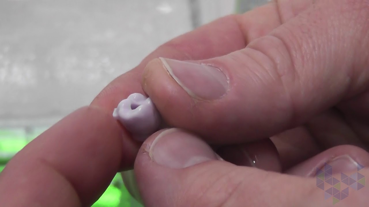 Cerec. Изготовление постоянной цельнофрезерованной коронки в одно посещение.