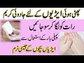 Cracked heels treatment by jasmine phati arion ka ilaj in urdu  phati ariyan ka treatment