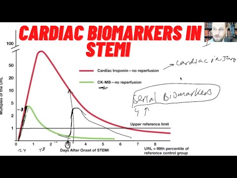וִידֵאוֹ: האם טרופונינים מוגברים באנגינה לא יציבה?