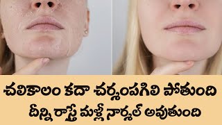 How to Reduce Dry Skin | Get Smooth and Soft Skin | Glowing Skin Remedies |Dr.Manthena's Beauty Tips