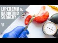 Lipedema  bariatric surgery  total lipedema care