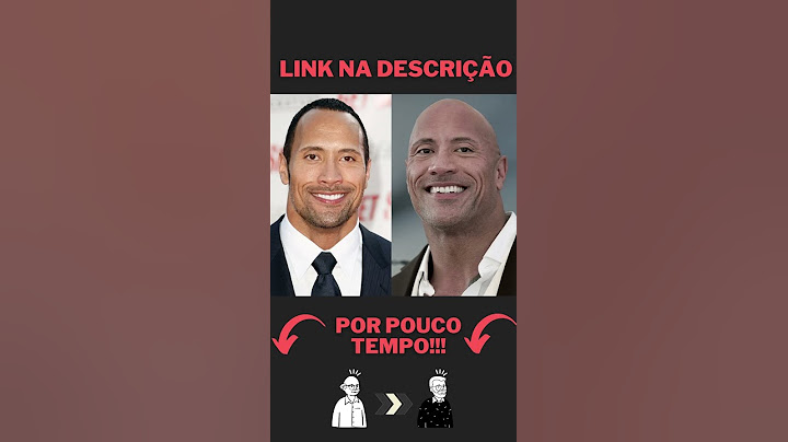 Famosos que já foram Carecas!!! #shorts #bald #careca #famous #fama #satisfying #satisfyingvideo