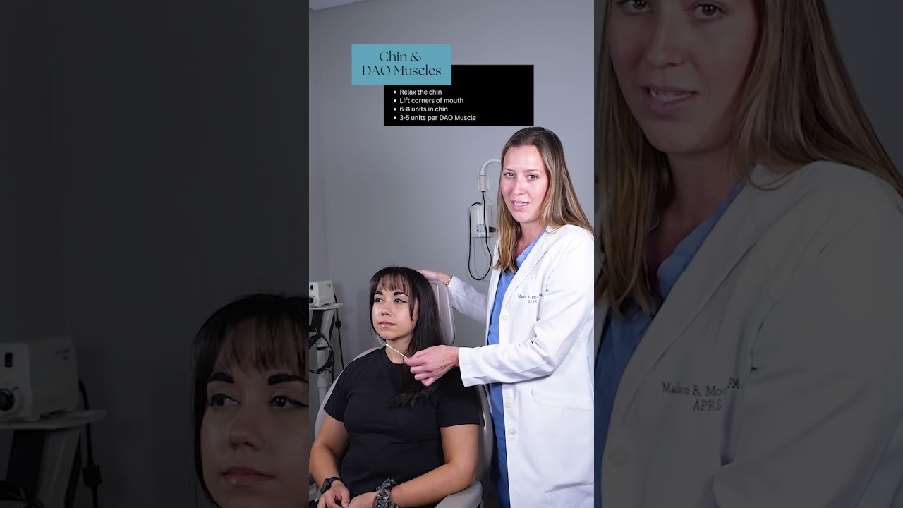 Areas you can Get Botox in the Lower Face