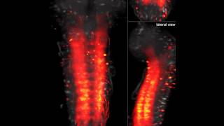 Neural Map of Living Fruit Fly Larva Captured for First Time