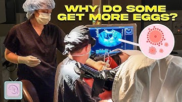 IVF - Why do some people get more eggs?