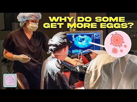 IVF - Why do some people get more eggs?