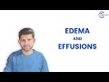 Edema and Effusions – Mechanisms &amp; Classification | Robbins Pathology