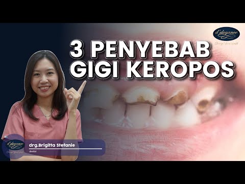 Video: Kenapa gigi saya mudah patah?