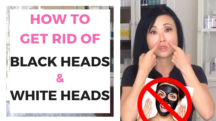 Tips on How to Remove Blackheads and Whiteheads
