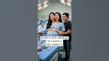 viral, wanita yang memiliki dua kepala melahirkan bayi kembar, #viralvideo #kisahnyata #fyp