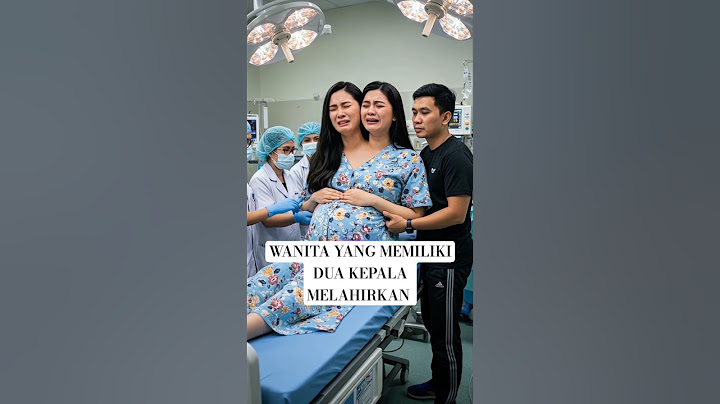 viral, wanita yang memiliki dua kepala melahirkan bayi kembar, #viralvideo #kisahnyata #fyp
