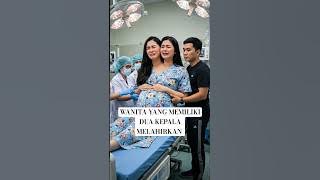 viral, wanita yang memiliki dua kepala melahirkan bayi kembar, #viralvideo #kisahnyata #fyp