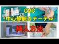 研修医必見❗CVC(中心静脈カテーテル)の挿入方法、手順