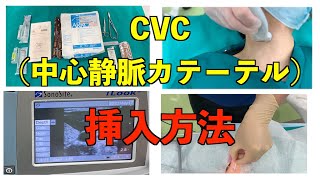 研修医必見❗CVC(中心静脈カテーテル)の挿入方法、手順