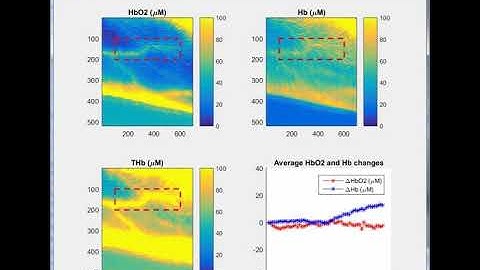 Real-time multi-fx SFDI for cuff occlusion measurements