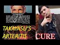 Dua Session #363- Takayasu's Arteritis Cure