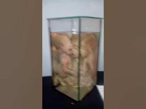 Заспиртованные дети мутанты - YouTube