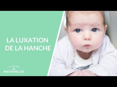 Vidéo: Dysplasie De L'articulation De La Hanche Chez Les Nouveau-nés