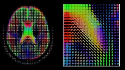 Pixels Visualised First Time By Me, Using Macro Lens