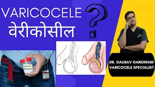 Answering 10 common questions about Varicocele | Varicocele treatment | Dr. Gaurav Gangwani