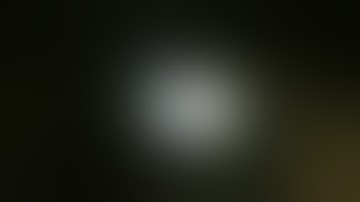 Sentinel node in vulvar cancer with Tc99 and ICG in women with vulvar cancer. Dr Lucas Minig.