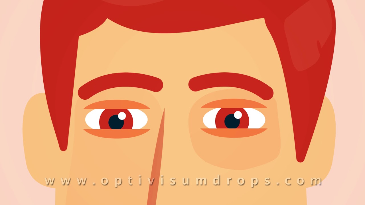OptiVisum - Hydration & Nourishment for Your Cornea - YouTube