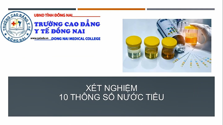 Các chỉ số xét nghiệm sinh hóa nuoc tieu năm 2024