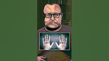 Normal Hands? | No, I’m Not A Human