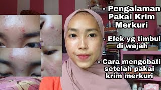 PENGALAMAN PAKAI KRIM MERKURI , EFEK YANG TIMBUL DI WAJAH , CARA MENGOBATI