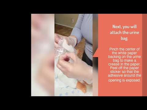 Video: Hvordan Ta På En Urinpose