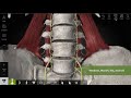 Anatomyka app  explore complete peripheral nervous system