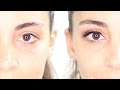 Yeux gonflés, paupières tombantes : Solution avec 2 Accessoires Beauté