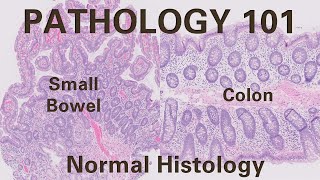 Normal Histology of Small Bowel and Colon | Pathology 101| GI Pathology
