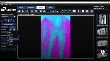 Tutorial - The Complete Guide To NanoPix X-Ray Sensor Software By Dr.Mohamed Tawakol - TDS, Egypt