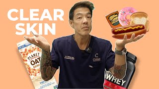 How your Diet and Gym Habits are causing Acne | Dr Davin Lim