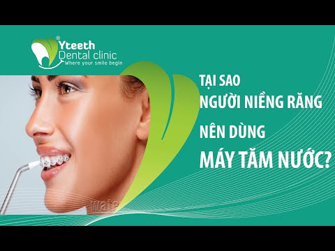 hướng dẫn vệ sinh răng miệng khi mang mắc cài tại Kemtrinam.vn